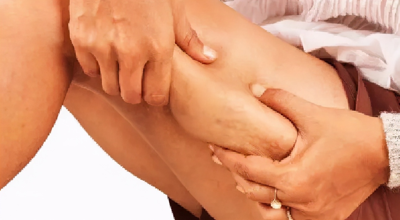 瘦腿霜会有用吗,瘦腿霜有用吗会反弹吗