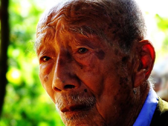 脸上的斑反映身体哪里出了问题,脸上绿豆大小的斑点是什么斑