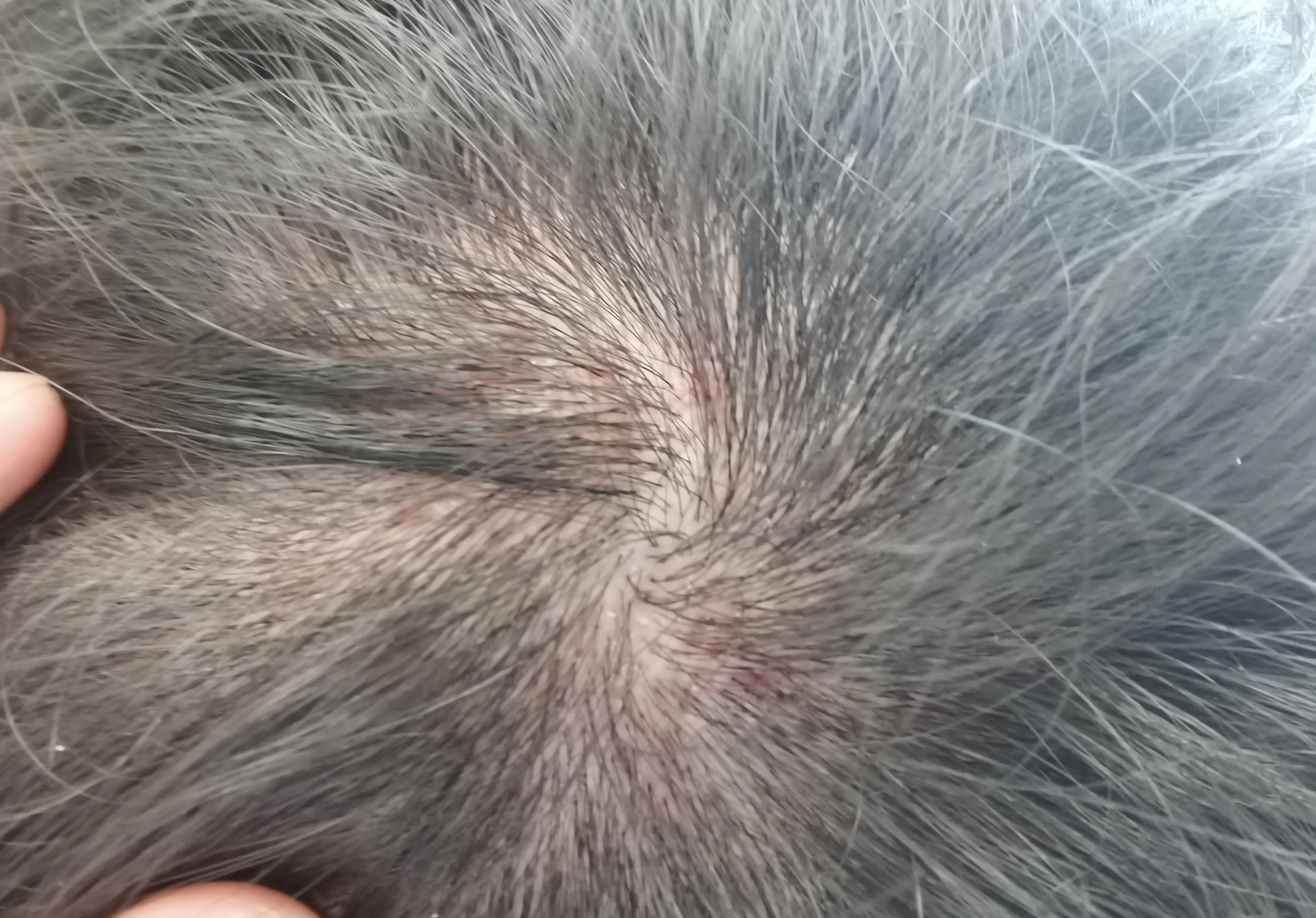 哺乳期头上痒有头皮屑起疙瘩,头上有大块的头皮屑胸下面有疙瘩