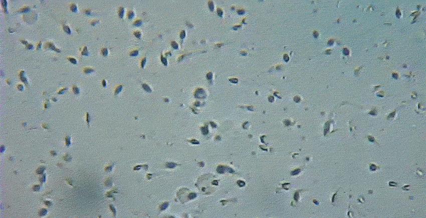 科学家发现精子运动规律,科学家们首次发现精子的运动规律