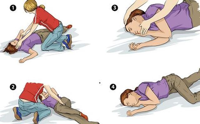 癫痫发作后怎么预防,癫痫发作后咬伤舌头需要急救吗