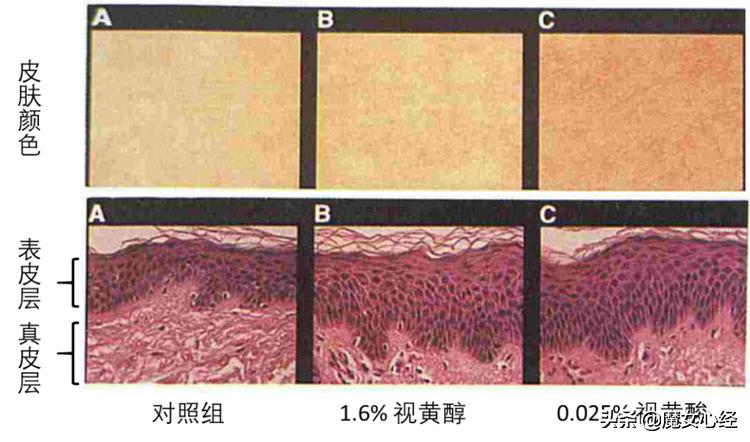 这样使用A醇产品，既能抗皱淡纹，又不伤害皮肤
