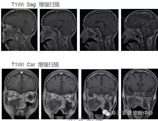 这些部位的黑色素瘤，您会诊断吗？