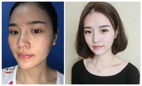 被太阳晒黑了怎样才能快速变白,手怎么才能快速变白