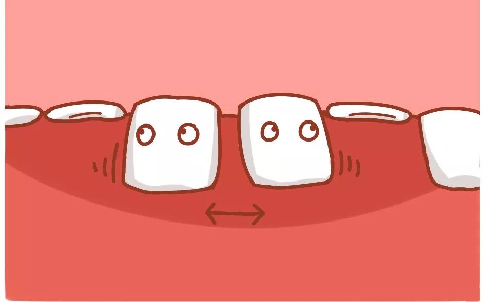 换牙两个门牙之间两毫米缝隙,儿童换牙两门牙中间缝隙大