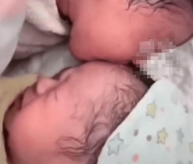 抗麻体质生宝宝剖腹产怎么办,抗麻体质可以生二胎吗