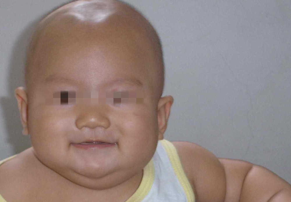 宝宝囟门闭合晚影响宝宝身高吗,宝宝的囟门闭合早好还是闭合晚好