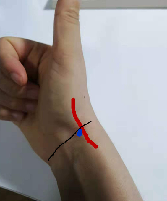 脚腕扭伤了怎么快速止痛,脚腕扭伤消炎止痛