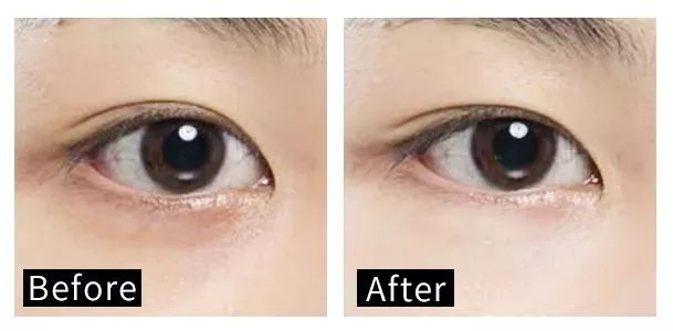 口罩一戴素面朝天,口罩一戴立马漂亮