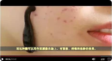 为了祛痘，小伙买10条活蚂蟥放脸上！结果悲剧了……