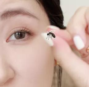 抗炎祛红痘痘,抗炎杀菌药膏痘痘