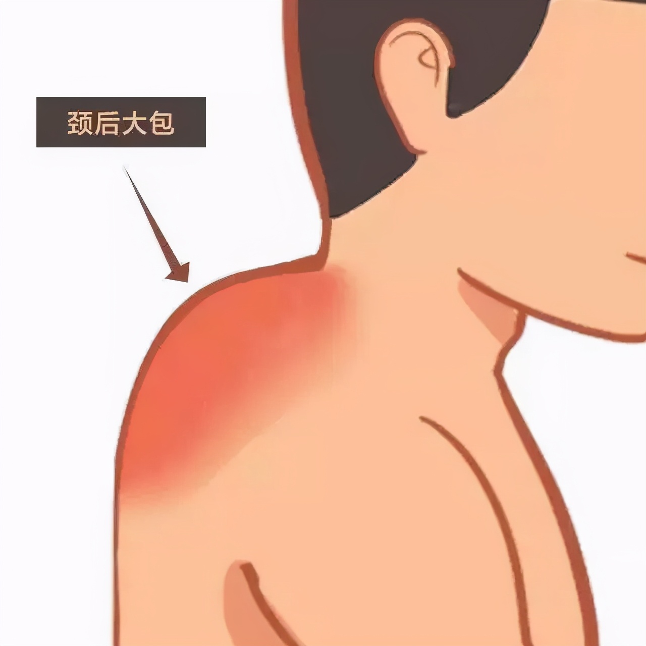 @打工人：不想“富贵包”变成“夺命包”，5招帮你消！