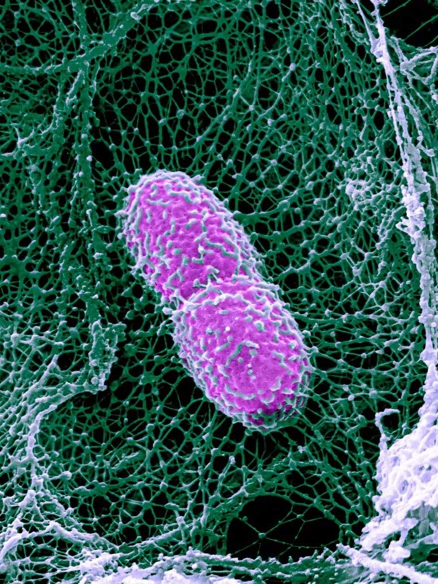 人体防卫战,人体痛点攻击技巧