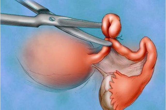 老外喜欢这些“避孕方式”，既舒适又不伤身，中国男女却难以接受