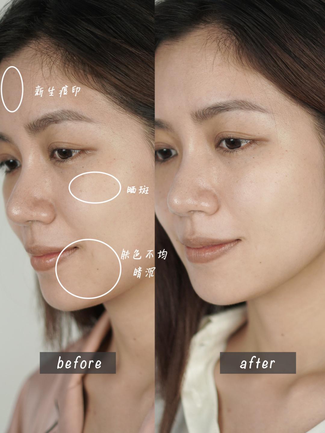 科颜氏淡斑小白瓶和小灯泡哪个好,科颜氏提亮美白