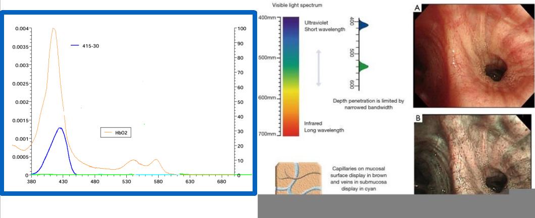 孙加源门诊,治疗肺癌的新技术新手段