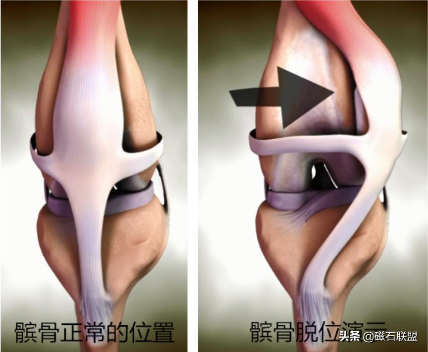 泰迪狗畸形,预防泰迪犬髌骨脱位哪款软骨素好