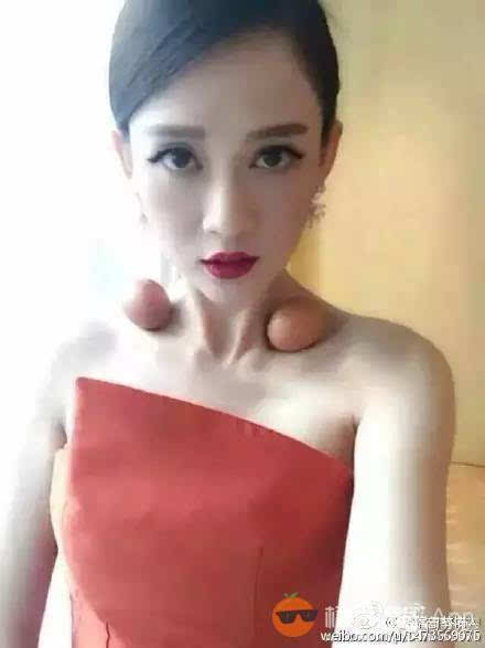 网红玻尿酸,为什么网红都打玻尿酸