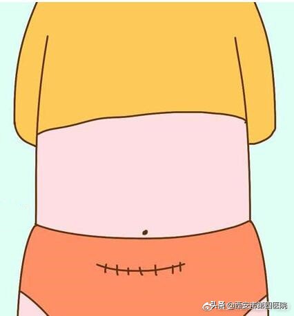 什么情况下选择剖腹产,什么情况可以选择剖腹产