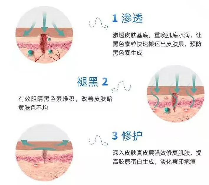 深圳治痘痘皮肤科哪个医院好啊,去皮肤科看痘痘好不好