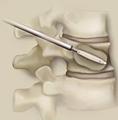 疼痛科需要有什么仪器,疼痛科必须具备的设备