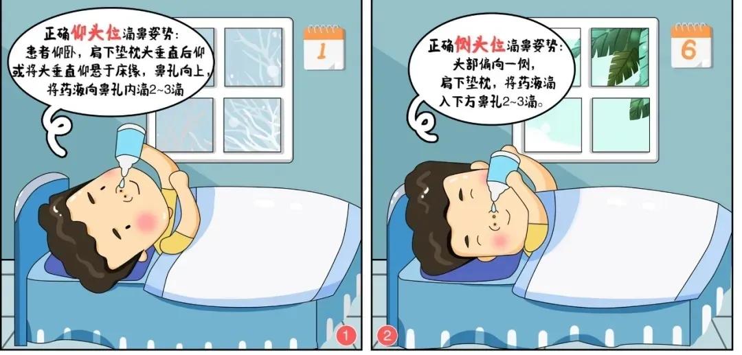 滴鼻液的正确方式,滴鼻液怎么滴鼻