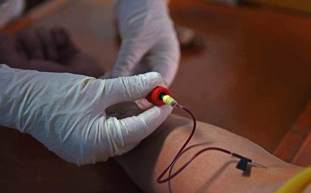 艾滋病血液离体10分钟还传染吗,艾滋病病毒离体后存活时间