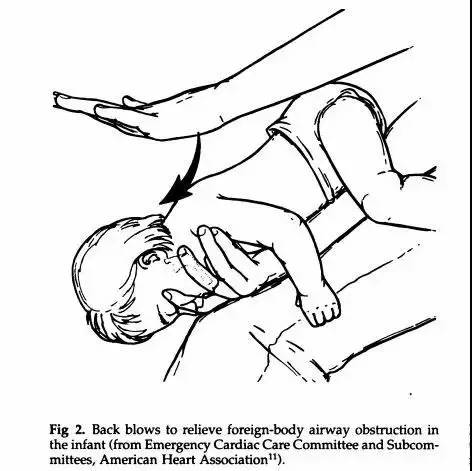 小孩吃东西呛到的最快解决方法,宝宝吃东西噎到急救视频
