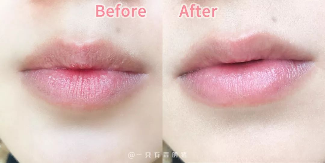 空管润唇膏,润唇膏空管