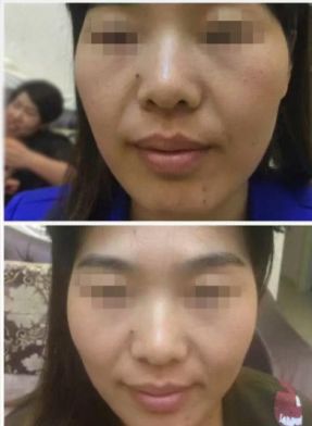 有人天生皮肤很黑然后怎么变白呢,天生皮肤黑怎么调理能变白