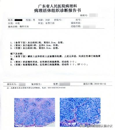 萎缩性胃炎你需要知道的5个点,萎缩性胃炎很吓人看完你就懂了