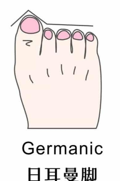 不同的脚型适合什么样的凉鞋,女人脚宽夏季怎样选适合的鞋子