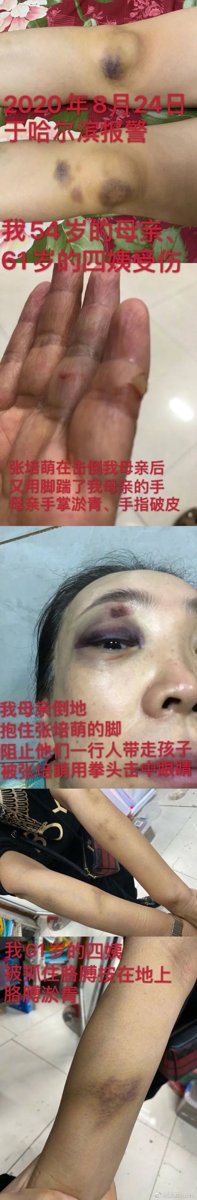 运动员被曝家暴,长跑运动员被家暴