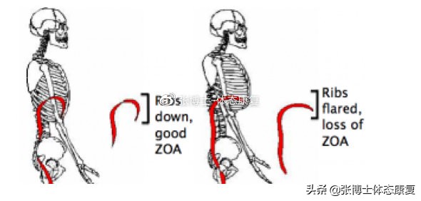 骨盆前倾造成的错位,单侧骨盆倾斜矫正方法