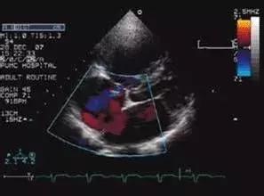 超声专家是做b超还是看结果,超声影像检查专家