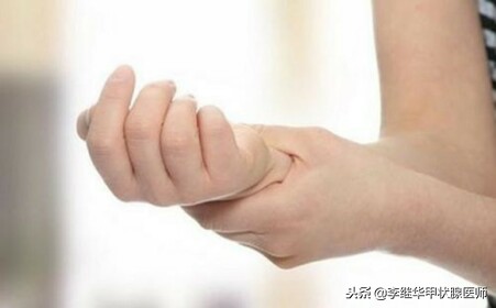 甲亢肌无力患者,甲亢肌无力并发症怎么治疗