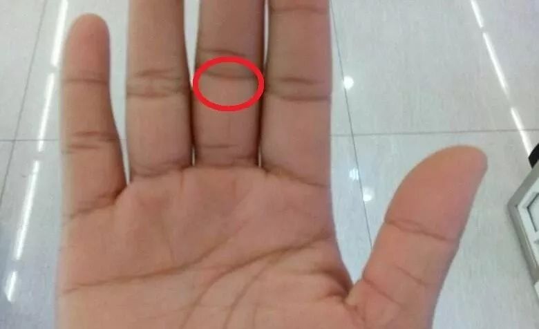 手诊10种常见病从手上就能看出来,手形看健康