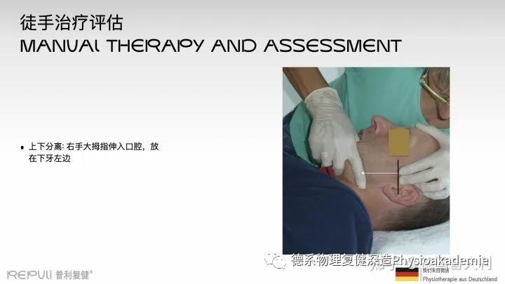 颞下颌关节紊乱综合征,颞下颌关节紊乱主要检查什么项目