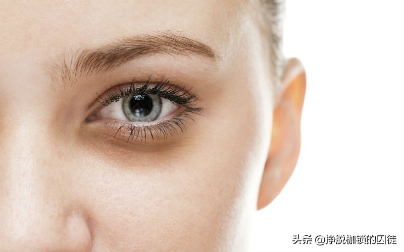 女孩黑眼圈重什么原因造成的,黑眼圈是什么原因造成的啊