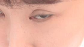 美甲店里做坏“双眼皮”，“名医”、店主全失联了…