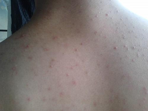 上海涤诺硫磺皂的作用与功效,硫磺皂的作用与功效可以洗头吗