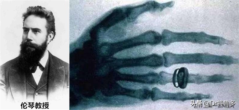 怀孕初期照了x光有影响吗,照了手部x光当月怀孕了有影响吗