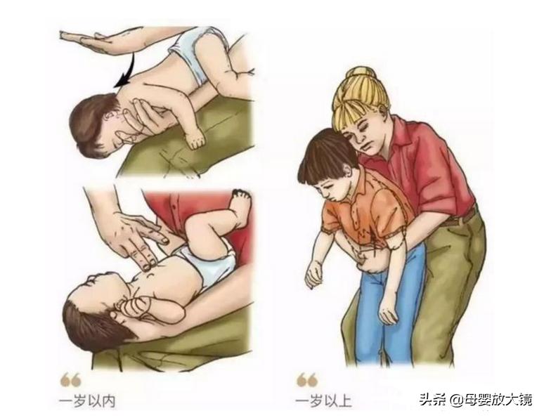 几个月宝宝吃东西被卡怎么办,大人被卡住急救方法能拍背吗