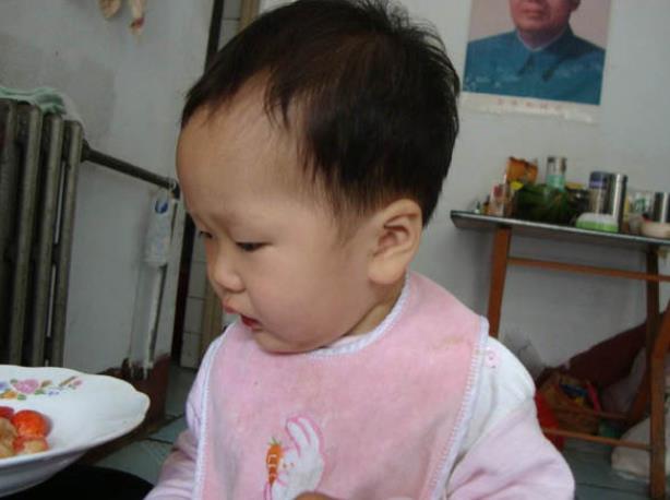 一岁三个月宝宝积食应该吃什么饭,3岁儿童积食解决方法