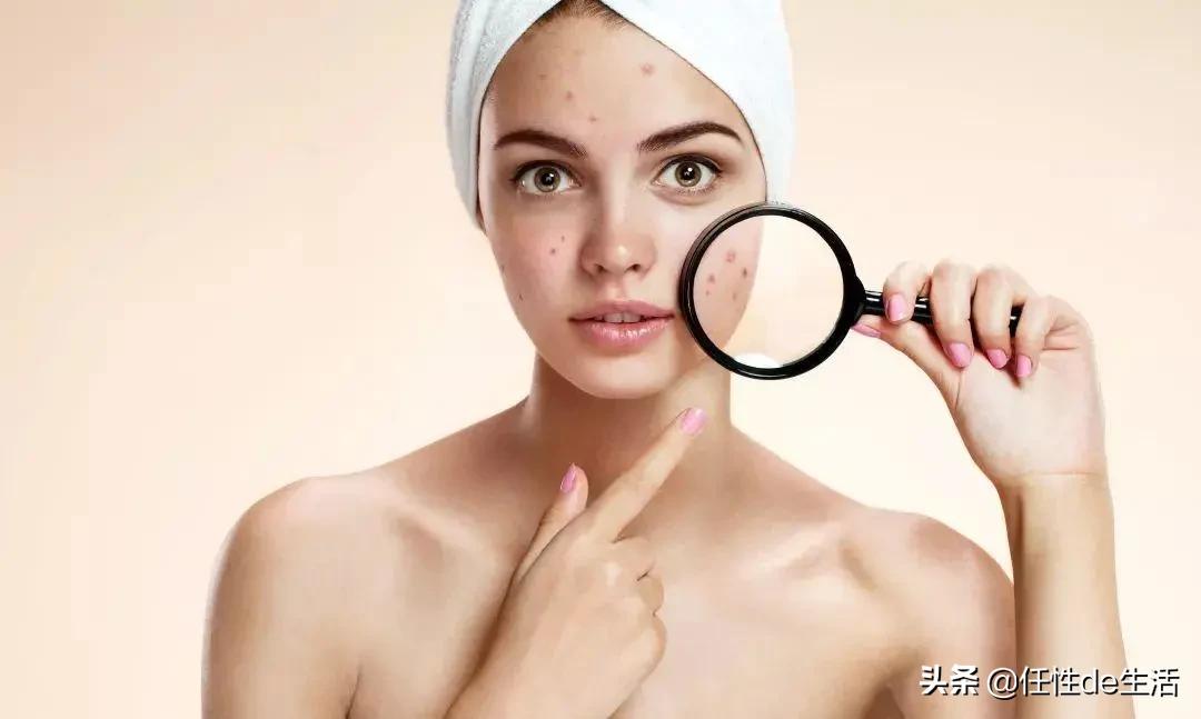 刷酸为什么避开脸颊,刷酸会脸垮吗