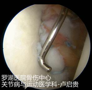 中超运动员受伤,足球黄嘉俊