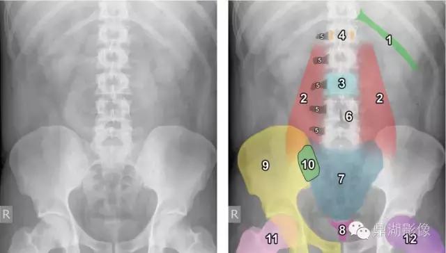 X线高清图谱|精致腹部解剖