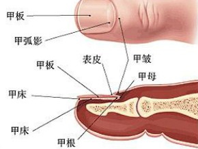 灰指甲清理过程,灰指甲能根治吗