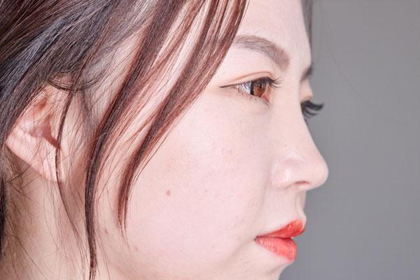 怎么去狐臭脱腋毛,脱腋毛怎样有效避免狐臭