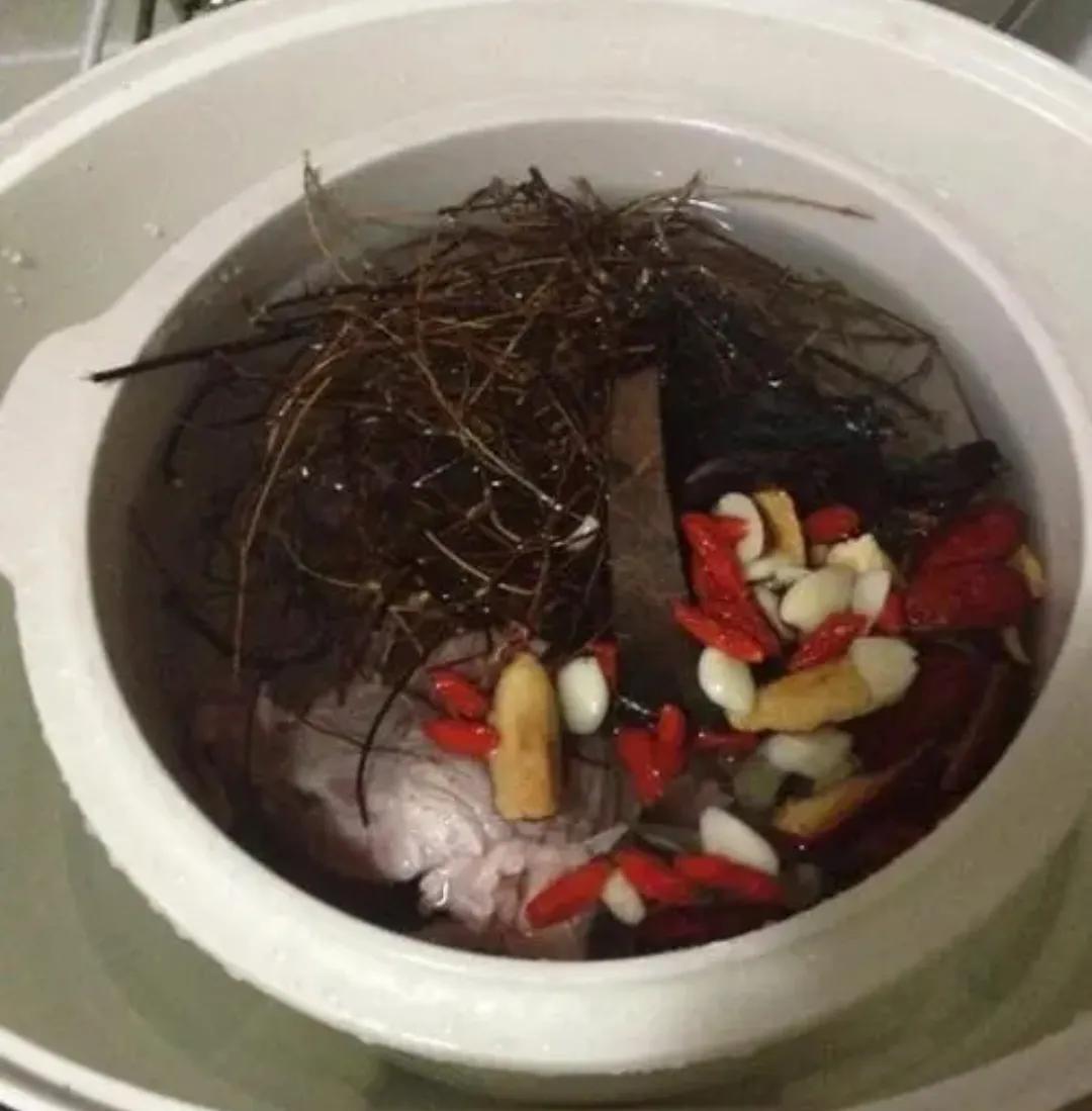 甲型黄疸型肝炎恢复的标准,黄疸型肝炎治疗多久可以治愈